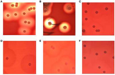 Identification and Characterization of Staphylococcus aureus Strains with an Incomplete Hemolytic Phenotype